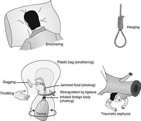 porn hanging|Asphyxiation, Hanging & Choking .